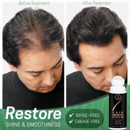 Hair Growth SERUM - MeraPopi