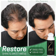 Hair Growth SERUM - MeraPopi
