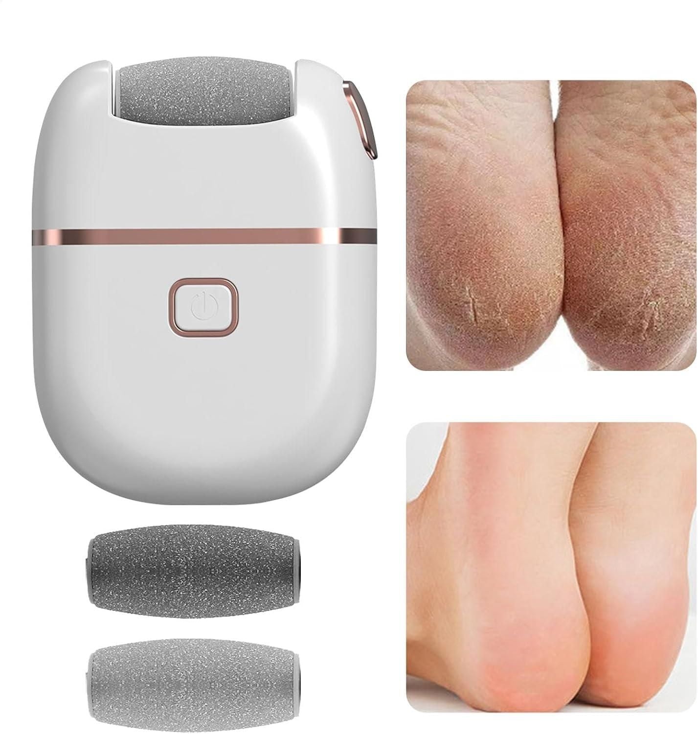 Electronic Pedicure Tool - MeraPopi