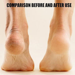 Electronic Pedicure Tool - MeraPopi